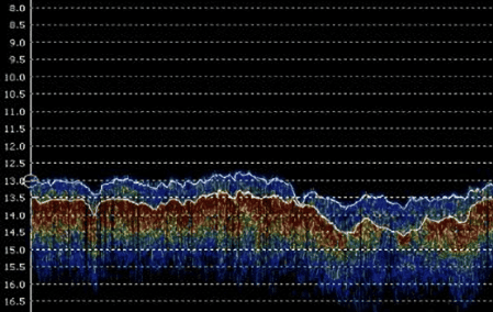 Single beam sonar