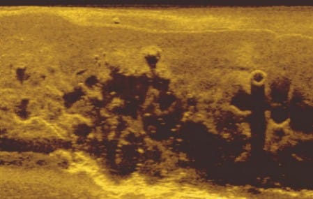 Sidescan sonar